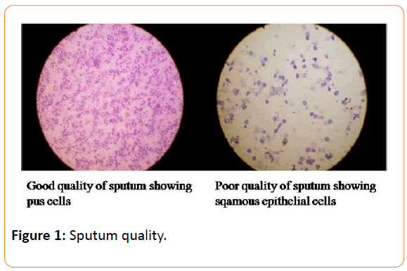 acmicrob-Sputum quality